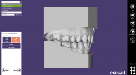 고덕동치과, 보험 임플란트? 추가 비용이 왜 나오는 거죠? 관련 이미지 10