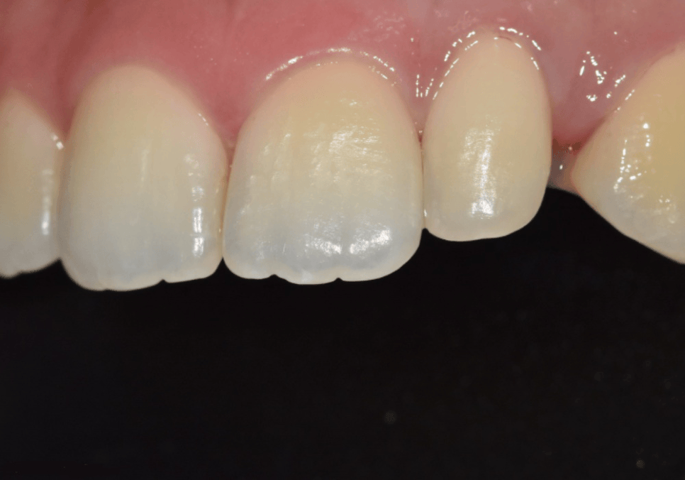 강일동 라미네이트 가격 망설여질 때 꼭 확인해야 할 관련 이미지 8