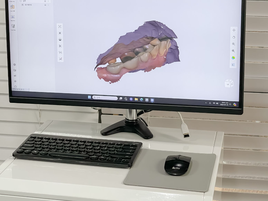고덕역 치과 위아래 전체 임플란트 디지털을 사용하는 이유? 관련 이미지 9