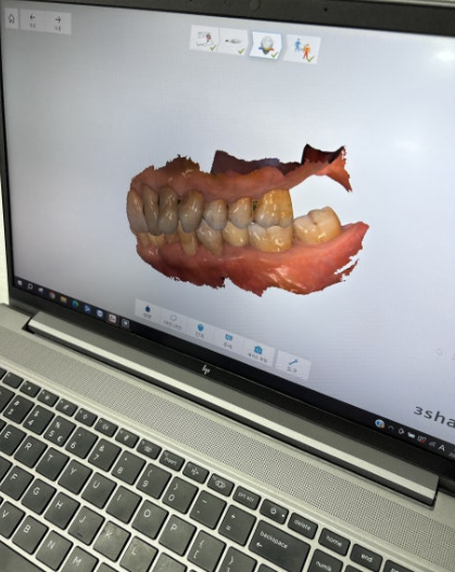 고덕동 치과 구강 스캐너 왜 좋다는 것일까? 관련 이미지 5