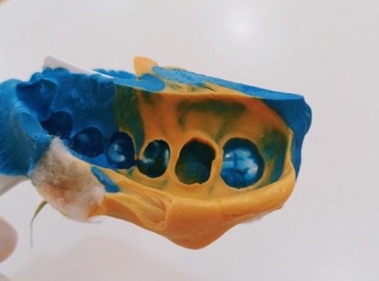 명일역 치과 보철 대표원장이 직접 제작합니다. 관련 이미지 2