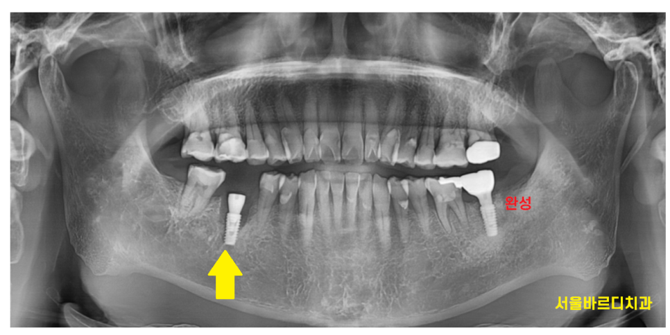 하남 미사 치과 공포증 치료가 두려우신 분들 컴온 관련 이미지 9