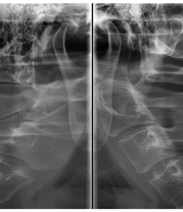 상일동역 턱관절 명절 음식 조심히 드세요!!!! 관련 이미지 1