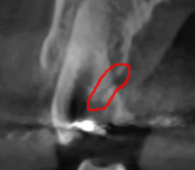 강동 치과 과잉 진료를 피하려면 이것을 확인하세요!! 관련 이미지 1