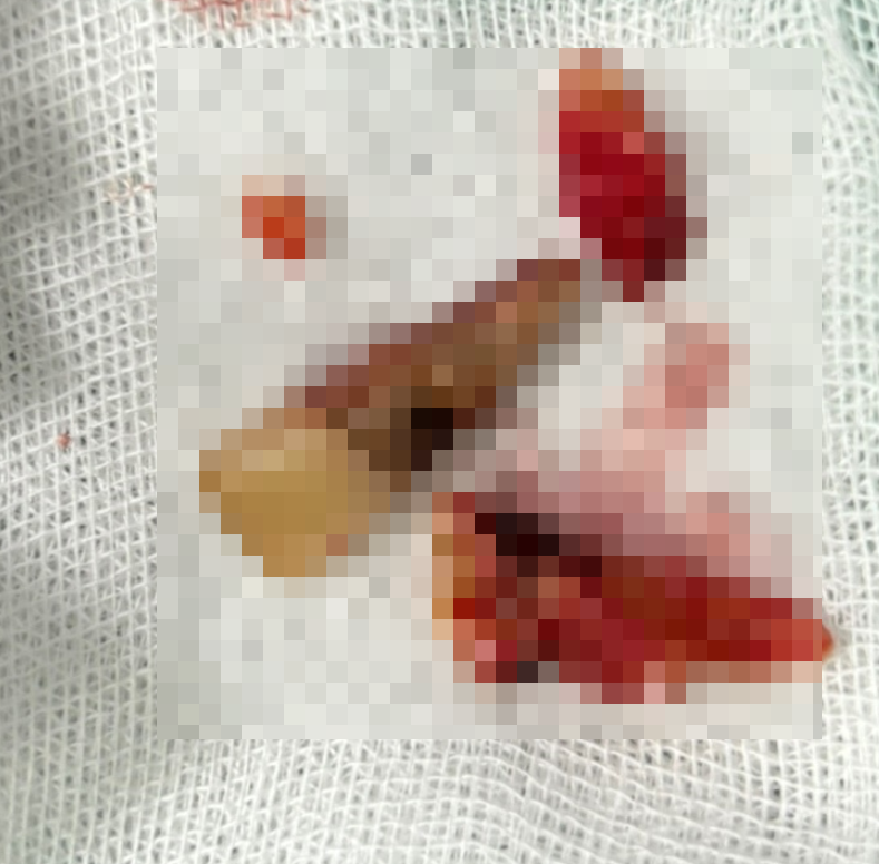 서울 임플란트 병원 선택 전 체크해야할 사항 고민은 이제 그만~ 관련 이미지 7