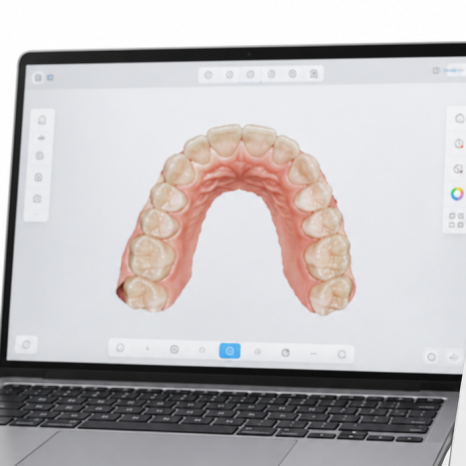 “Taking Impressions” Is Disappearing: What’s Different About Digital Impressions with an Intraoral Scanner? image 4