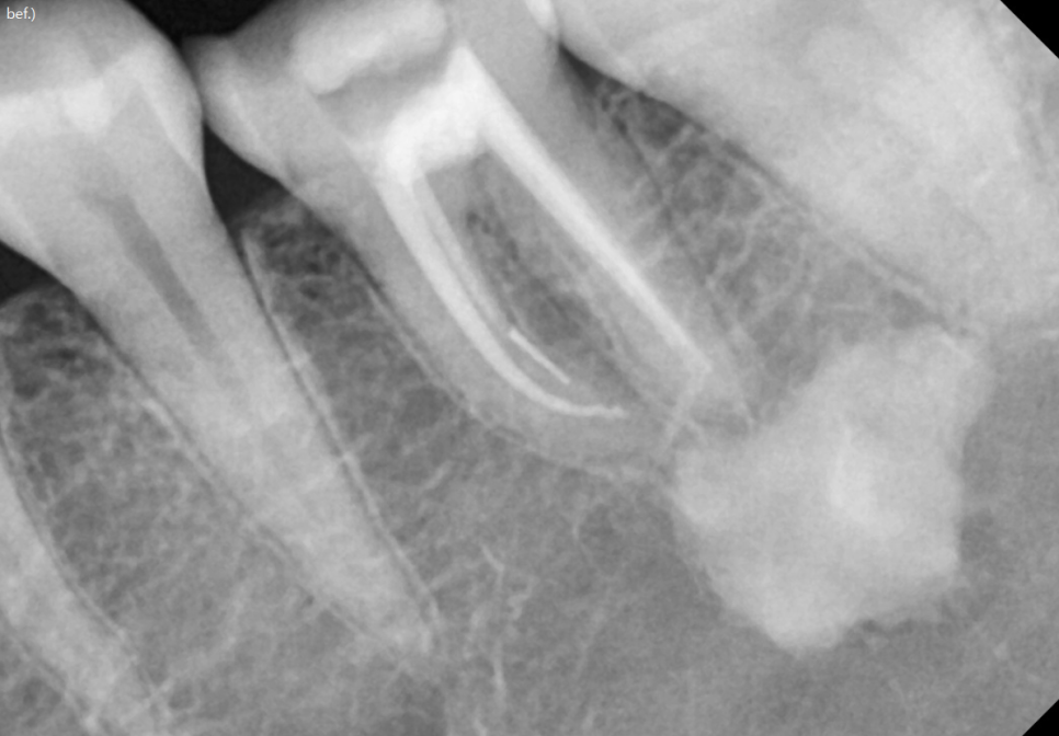 임산부 치과치료 길동 사거리 치과가 알려드립니다. 관련 이미지 3