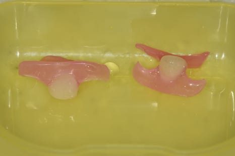 고덕동 아래 앞니 임플란트 비용 줄이는 비법, 공개합니다. 관련 이미지 10