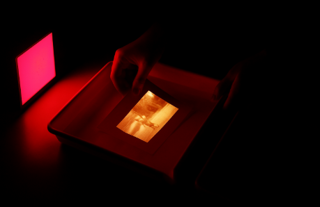 이 뽑고 바로 임플란트 심어도 될까요?? 관련 이미지 5