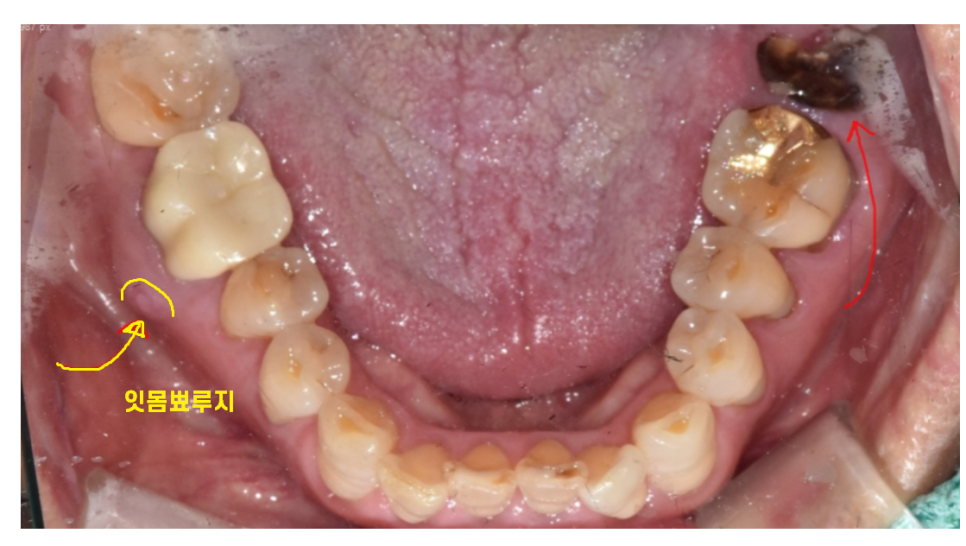 하남 미사 치과 공포증 치료가 두려우신 분들 컴온 관련 이미지 6