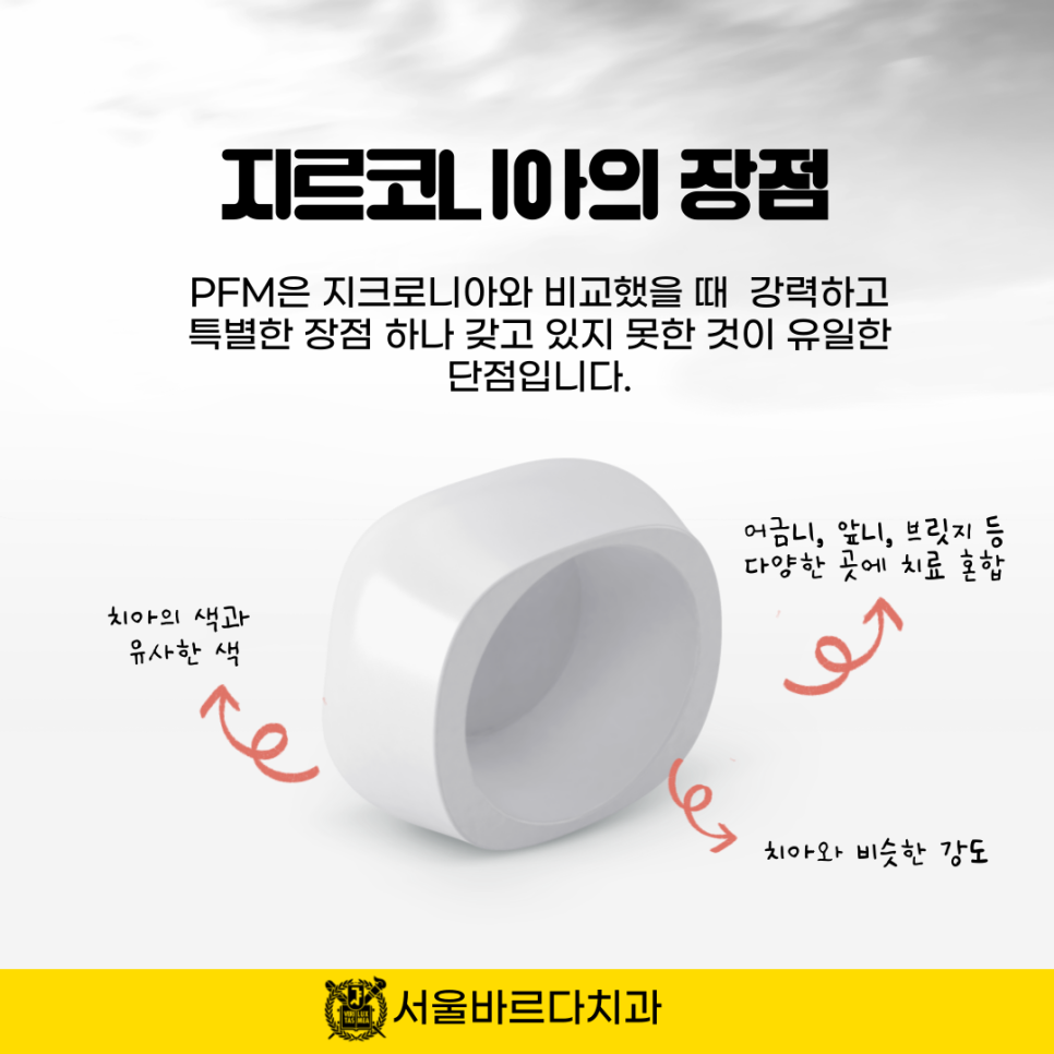 상일동치과 서울바르다치과, 다 똑같은 크라운인지 알았는데 지르코니아와 PFM의 차이를 알고계신가요~? 관련 이미지 8