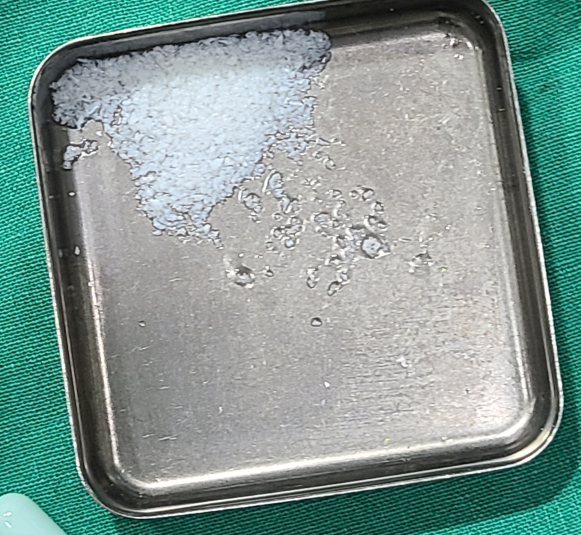 임플란트 1개 가격  무조건 저렴한 임플란트가 좋을까? 관련 이미지 3