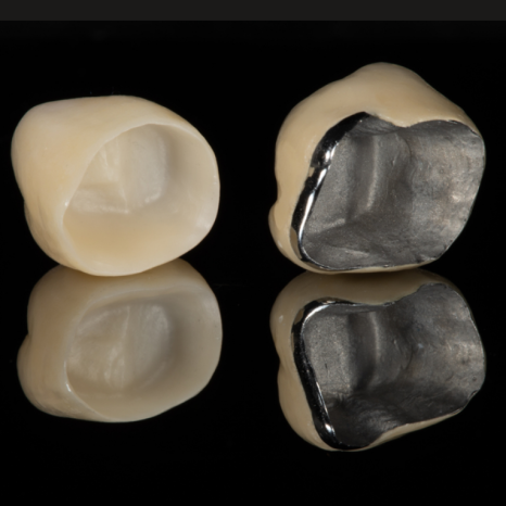 Tooth-Colored Dental Crown Types: PFM and Zirconia (Ziconia) image 1