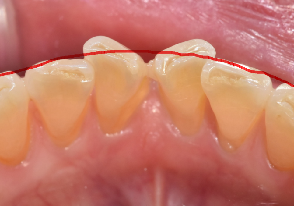 삐딱하게 뻗은 관련 이미지 8