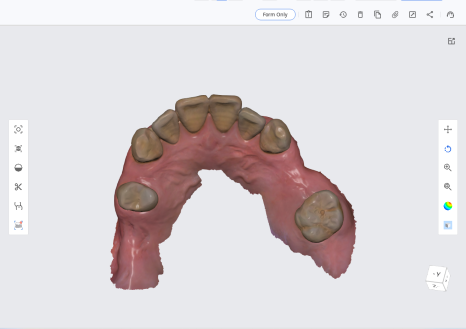 네비게이션 임플란트가 왜 좋다고 그러는거죠? (feat.13가지 장점) 관련 이미지 1