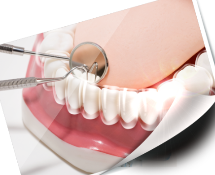 고덕역 근처 교정 치과 치료기간은 얼마나 걸릴까? 관련 이미지 5