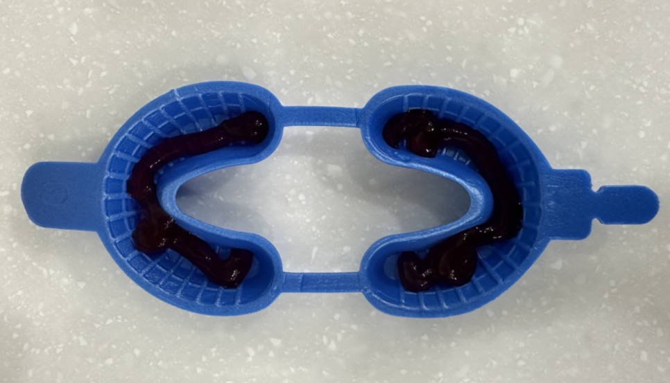 강동구 스케일링 받고 꼭 필요한 한 가지 불소 관련 이미지 5