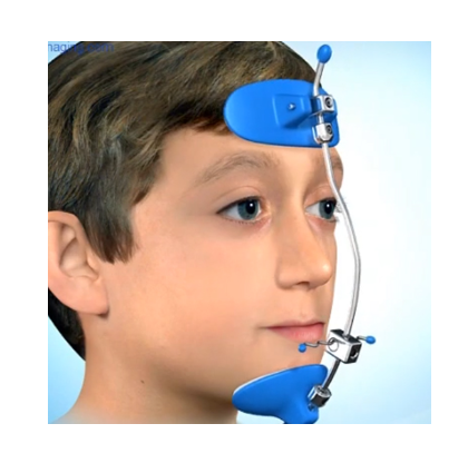 상일동 어린이 교정 성인 교정과 다르기에 놓치지 말아야합니다! 관련 이미지 4