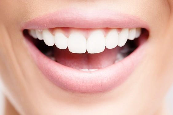 치아 미백 후 주의사항: 건강한 미소를 유지하는 방법 관련 이미지 1