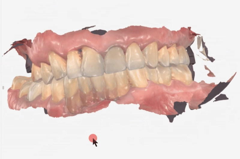 Sangil-dong Station Implant Visits: How Many Times Do You Actually Need to Go to the Dentist? image 8
