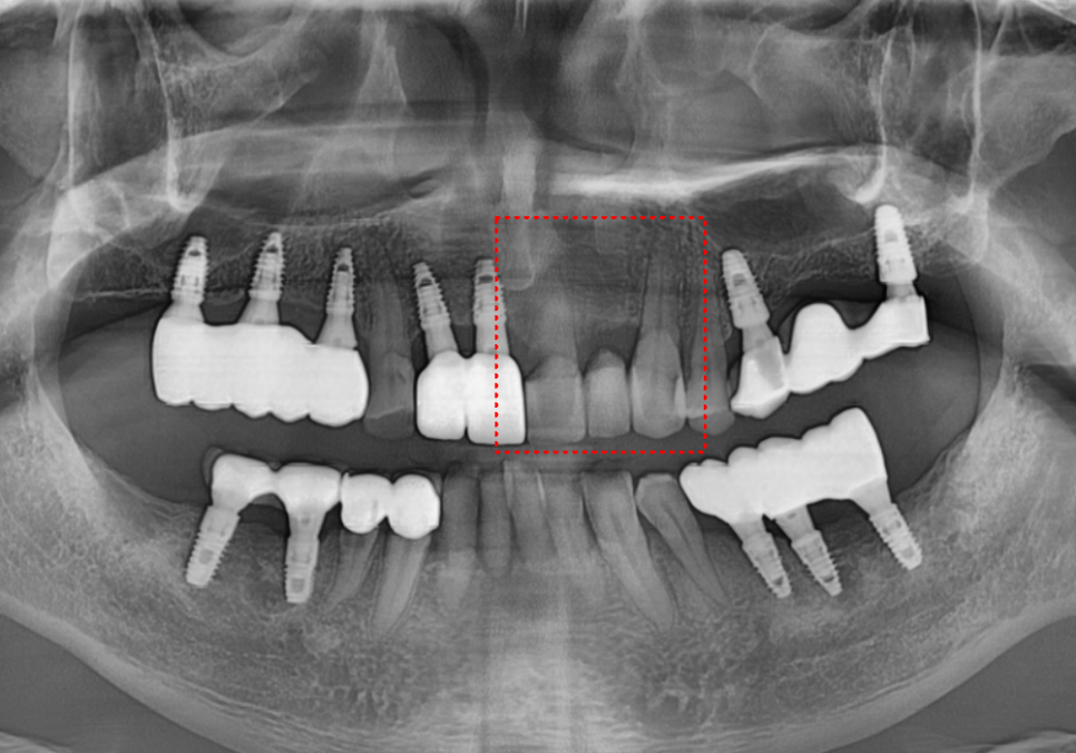 음식물 끼임, 거뭇한 무언가 보인다면? 이미 늦었을 수 있습니다. 관련 이미지 1