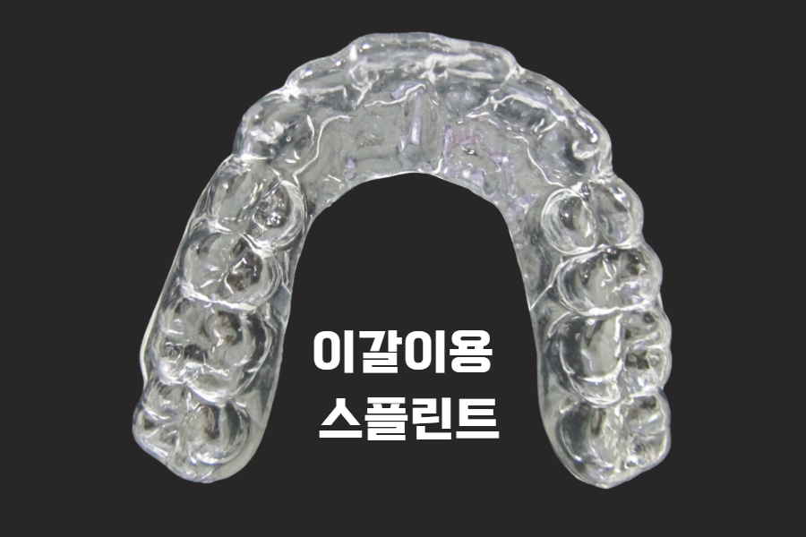 아침에 일어날 때 어금니가 욱신거린다면? 이 습관을 의심해 봐야 합니다. 관련 이미지 5