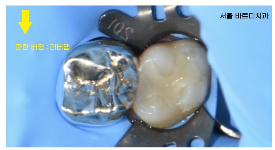 상일동역 치과 작은 것도 놓치지 않는 원칙진료를 시행합니다. 관련 이미지 6