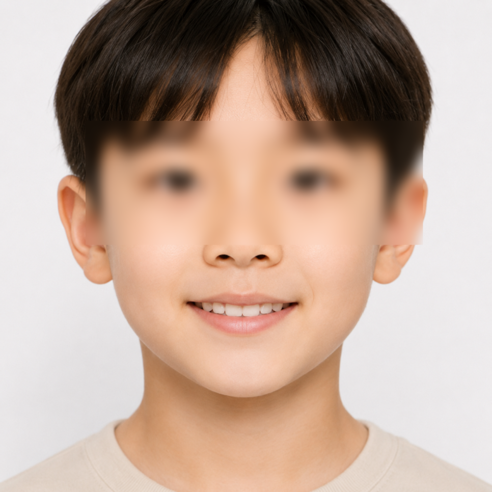 우리 아이 주걱턱, "크면서 괜찮아지겠지"가 위험한 이유 관련 이미지 6