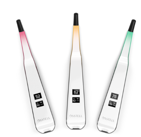 상일동 임플란트 상악동 거상술을 동반한 수술 증례 관련 이미지 10