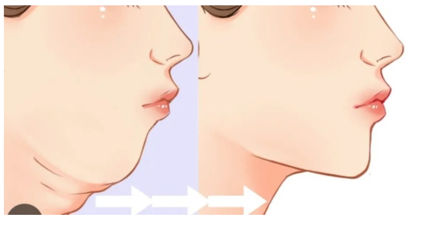 Adult Chin Correction: It Can Go Beyond Appearance Issues and Even Disturb You During Sleep image 4