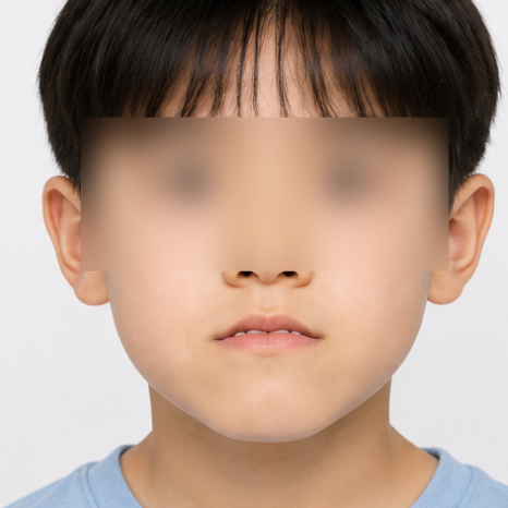 우리 아이 주걱턱, "크면서 괜찮아지겠지"가 위험한 이유 관련 이미지 3