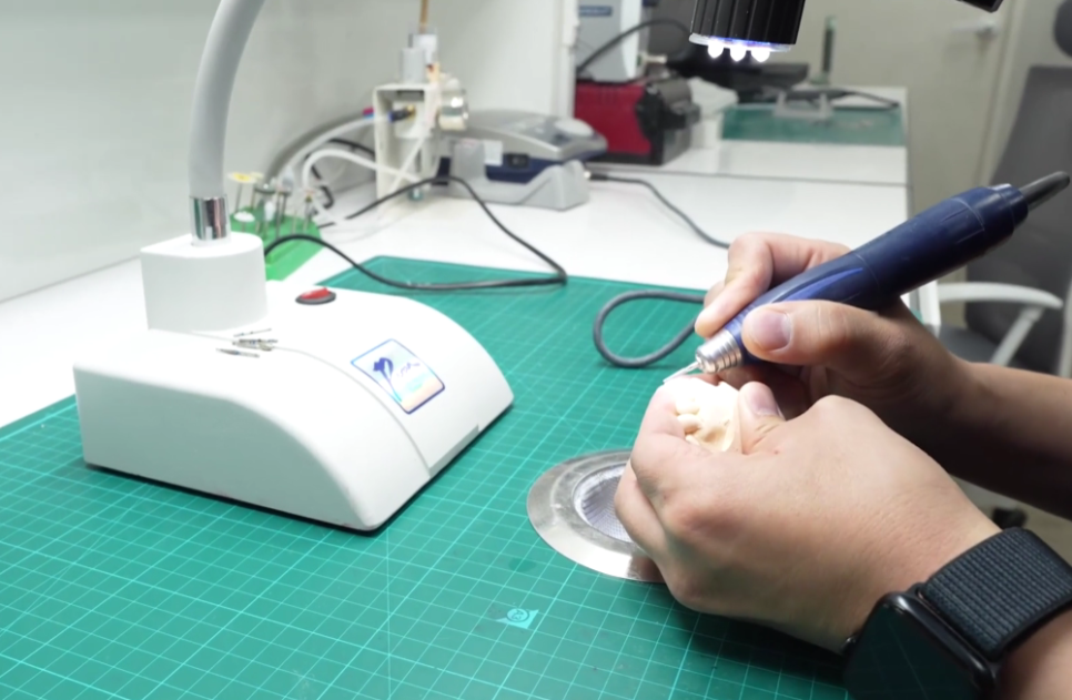 상일동역 라미네이트, 왜 누군가는 부작용을 겪고, 누군가는 10년 넘게 멀쩡할까? 관련 이미지 11