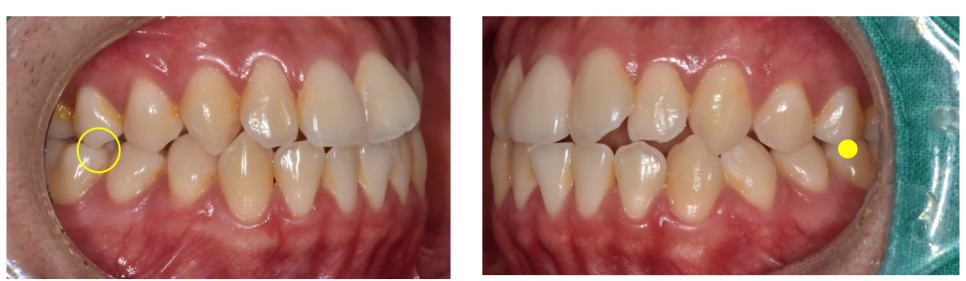 Godeok Station Dental Clinic: If You’re Considering Starting Adult Clear Aligners, Click image 6