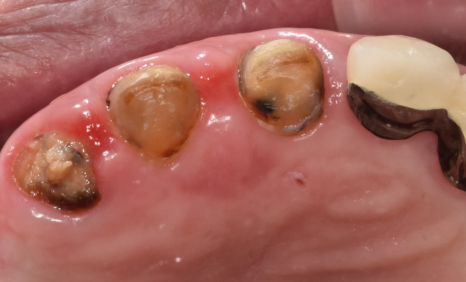 합죽이입 처럼 보이는 이유, 낮아진 관련 이미지 10