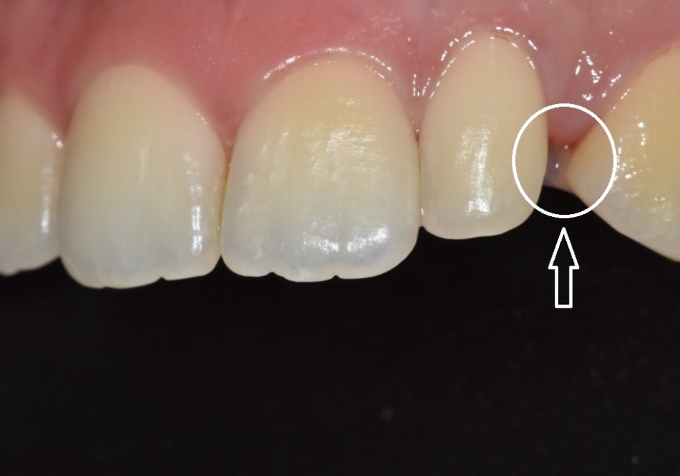 강일동 라미네이트 가격 망설여질 때 꼭 확인해야 할 관련 이미지 9
