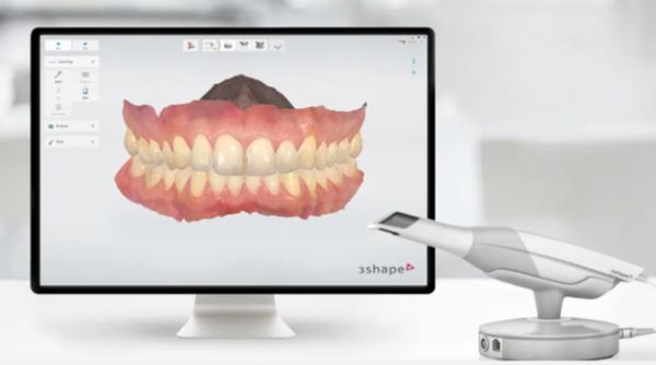 My Teeth Are Shaking So Much That Eating Is Uncomfortable—Is It Okay to Just Leave Them Alone? image 11