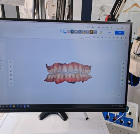 강동구 치과 임플란트 정답은 없습니다. 관련 이미지 5
