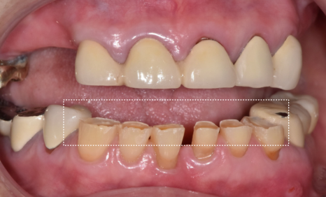 합죽이입 처럼 보이는 이유, 낮아진 관련 이미지 6