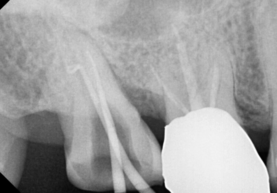 시큰거리는 통증, 시린 이 치약으로 해결 안 된다고요? 관련 이미지 9