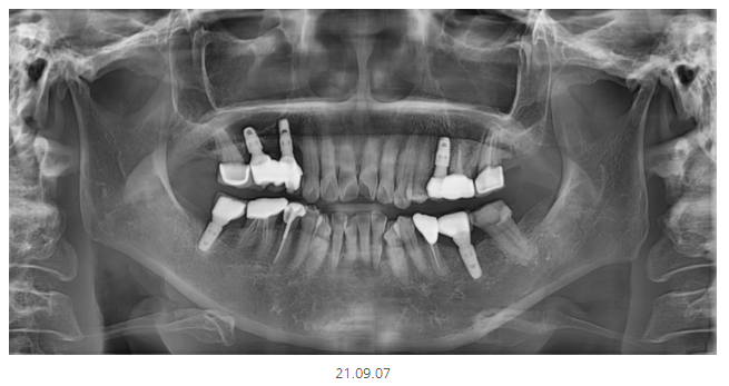 천호동 치과 과잉 진료를 피하는 방법 대공개 관련 이미지 5