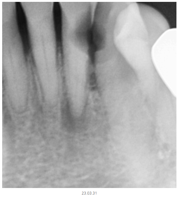 천호동 치과 과잉 진료를 피하는 방법 대공개 관련 이미지 7