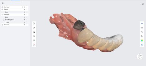 네비게이션 임플란트가 왜 좋다고 그러는거죠? (feat.13가지 장점) 관련 이미지 10