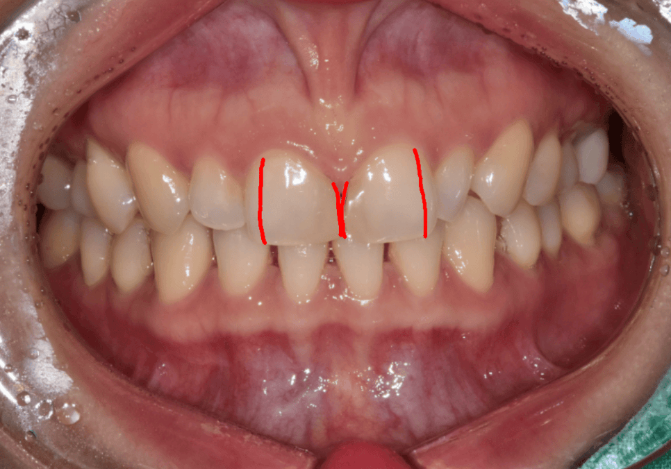 강일동 라미네이트 가격 망설여질 때 꼭 확인해야 할 관련 이미지 4