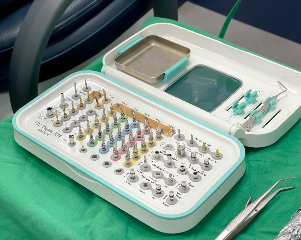 서울 임플란트 병원 선택 전 체크해야할 사항 고민은 이제 그만~ 관련 이미지 4