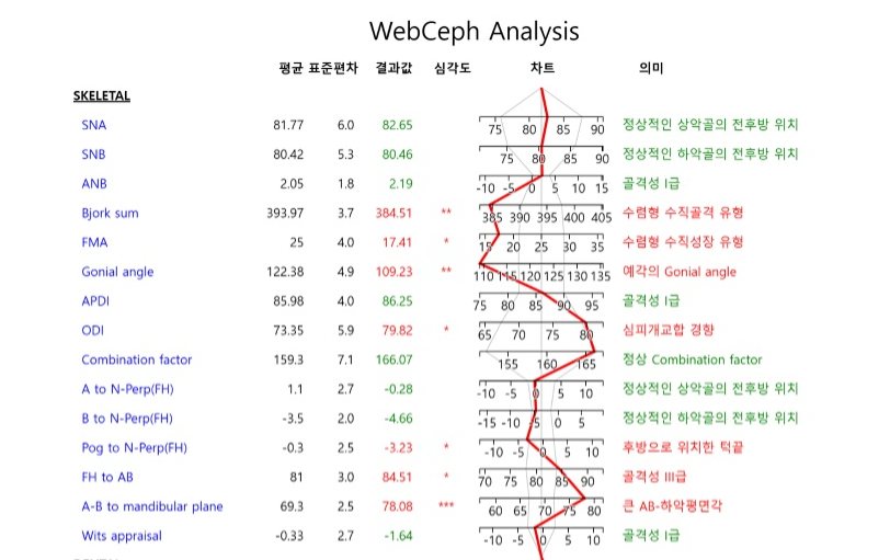 치아 교정 중 사랑니 뽑아야할까?? 관련 이미지 5