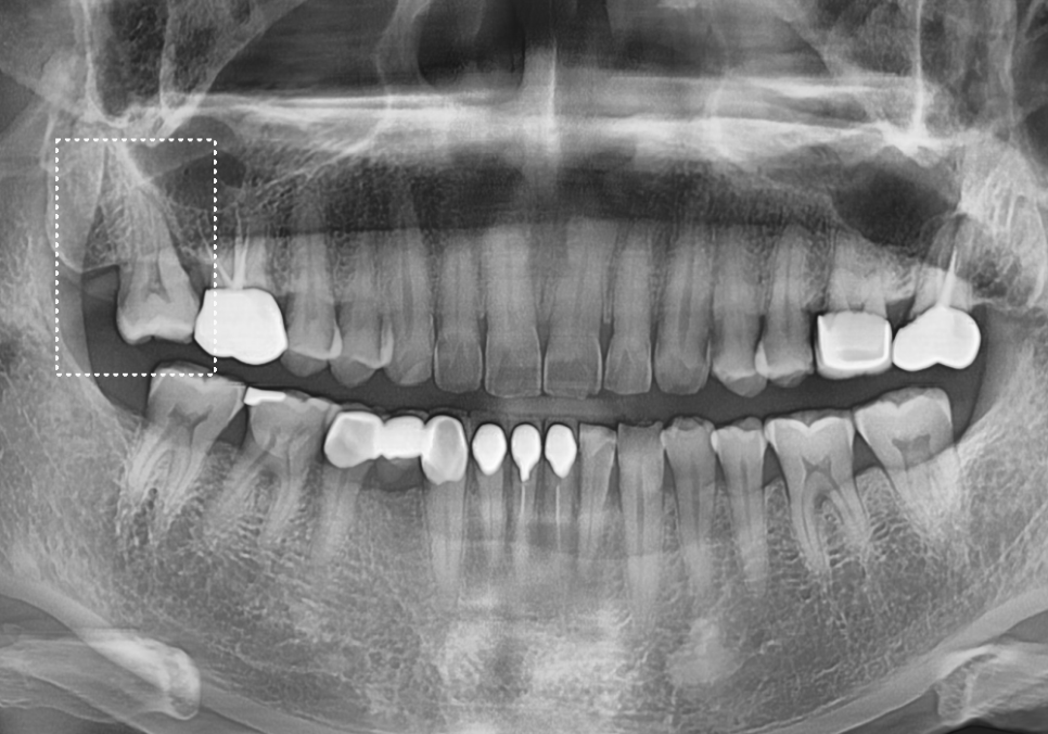 시큰거리는 통증, 시린 이 치약으로 해결 안 된다고요? 관련 이미지 5
