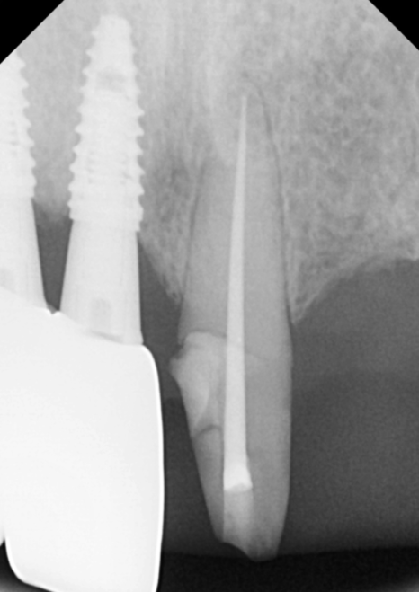 음식물 끼임, 거뭇한 무언가 보인다면? 이미 늦었을 수 있습니다. 관련 이미지 11