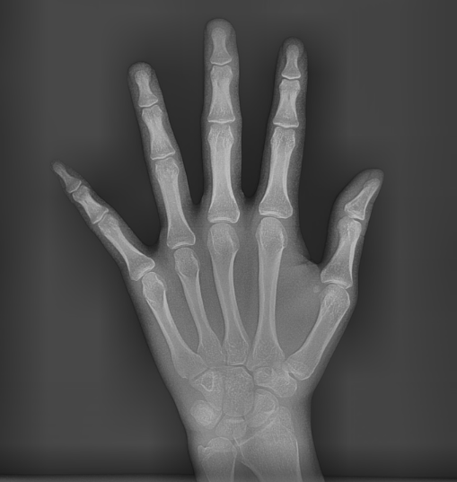 상일동 어린이 교정 성인 교정과 다르기에 놓치지 말아야합니다! 관련 이미지 2