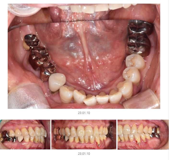 천호동 치과 과잉 진료를 피하는 방법 대공개 관련 이미지 10