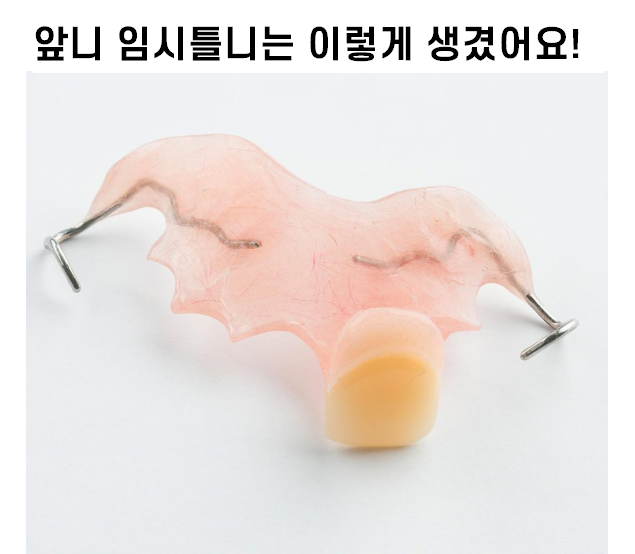 풍산동 임플란트 이 뽑고 임시틀니는 꼭 해야하나요? 플리퍼란? 관련 이미지 7